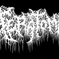 Teratoma