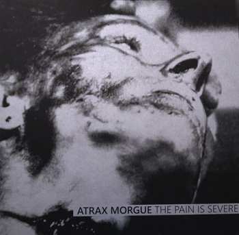 Album Atrax Morgue: The Pain Is Severe