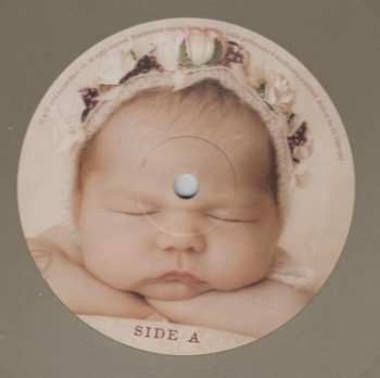 2LP Attitude