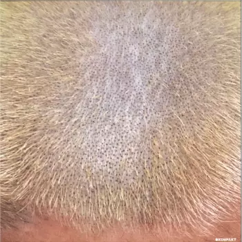 ProMetal Fan Decor Only Product