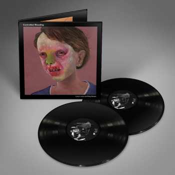 2LP Controlled Bleeding: Larva Lumps and Baby Bumps