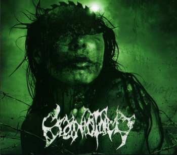 CD Craniotomy: Ripped Out By Violence