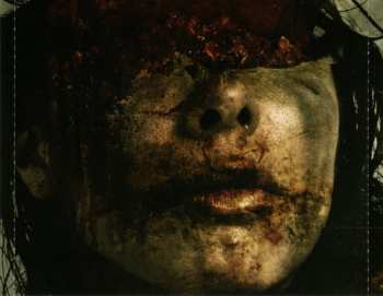 CD Craniotomy: Ripped Out By Violence