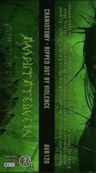 CD Craniotomy: Ripped Out By Violence