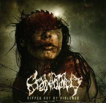 CD Craniotomy: Ripped Out By Violence