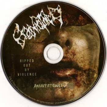 CD Craniotomy: Ripped Out By Violence