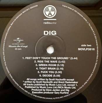 LP Dig: Dig