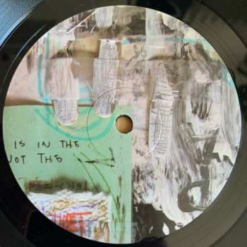 LP Forgetters: Forgetters