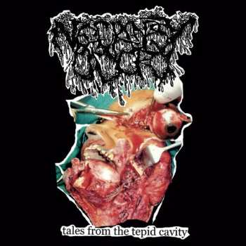 CD Necropsy Odor: Tales From The Tepid Cavity