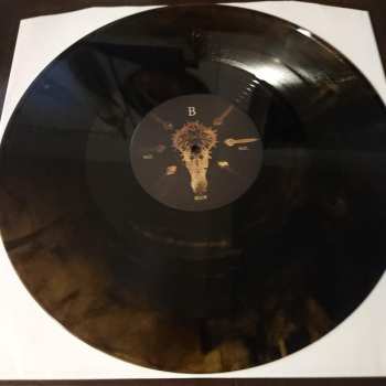 LP Organectomy: Nail Below Nail CLR