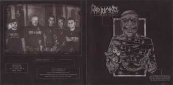 CD Parricide: Sometimes It's Better To Be Blind And Deaf 