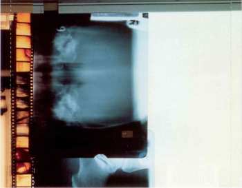 CD Recoil: Unsound Methods