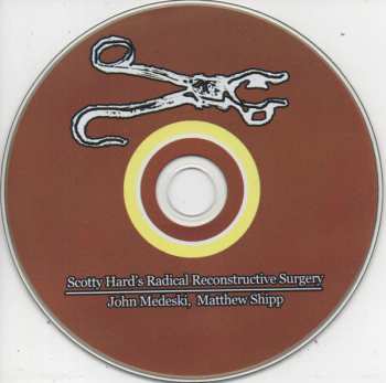 CD Scotty Hard: Scotty Hard's Radical Reconstructive Surgery