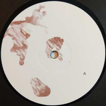 LP soft tissue: hi leaves