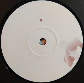 LP soft tissue: hi leaves