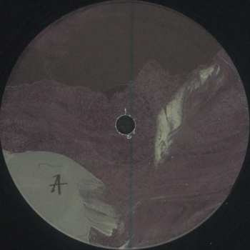 LP Stander: Vulnerable