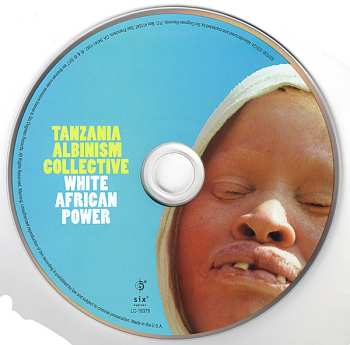 CD Tanzania Albinism Collective: White African Power