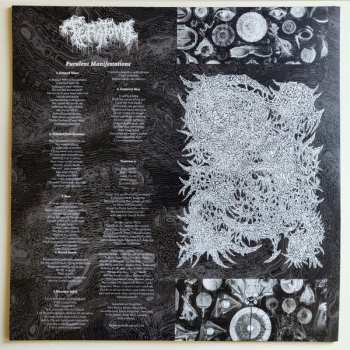LP Teratoma: Purulent Manifestations
