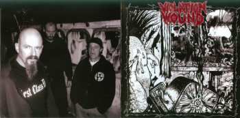CD Violation Wound: Violation Wound