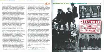 4CD/Coffret Zior: Before My Eyes Go Blind: The Complete Recordings